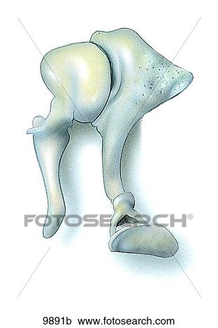 Stock Illustrations of Auditory Ossicles Unlabeled 9891b - Search