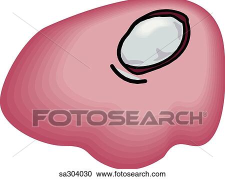 Stock Illustrations of Type of kidney stone. sa304030 - Search Clipart