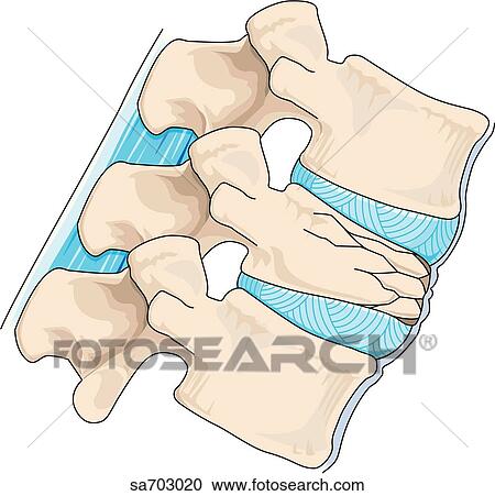 COMPRESION COLUMNA VERTEBRAL compresion columna vertebral: