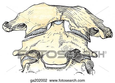 atlantoaxial joint