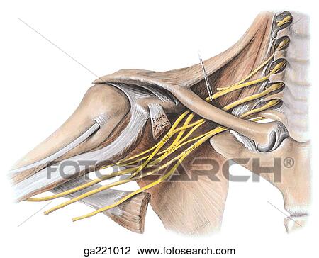 Clip Art - frühe ansicht, von, dass, brachial, plexus, und, ligamente