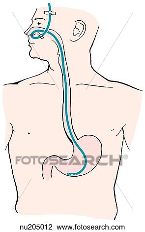 ANAL RECONSTRUCTIVE SURGERY PICTURES Cocks Cum Together