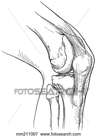 Stock Illustration of Knee joint mm211007 - Search EPS Clipart