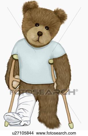 teddy bear with cast on leg