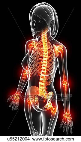 Drawings of Joint pain, artwork u55212004 - Search Clip Art