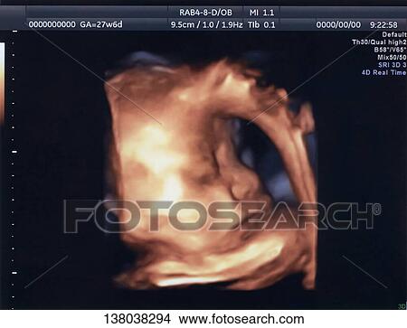 Picture - Fetal Ultrasound Scan. Fotosearch