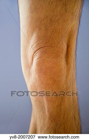 40 years old, 40-50 years old, 40's, Adult, Anatomy, Arthritis, Articulation, Biomechanical, Body, Bones, Bursitis, Care, Caucasian, Degeneration, Diagnosis, Disorder, Essential, Evaluation, Examination, Fit, Fitness, Forties, Forty View Large Photo Image Stock Photo - 40 years old, 40-50 years old, 40's, Adult, Anatomy, Arthritis, Articulation, Biomechanical, Body, Bones, Bursitis, Care, Caucasian, Degeneration, Diagnosis, Disorder, Essential, Evaluation, Examination, Fit, Fitness, Forties, Forty. Fotosearch