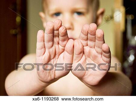 A child shows his hands after swimming - the skin of his fingers and palms is all wrinkled from being in the water for a while View Large Photo Image Stock Photo - A child shows his hands after swimming - the skin of his fingers and palms is all wrinkled from being in the water for a while. Fotosearch