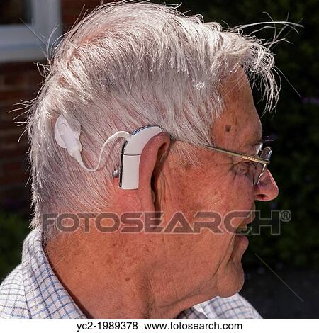 Stock Photo - A close up picture of an elderly man with his cochlear implant hearing aid in England, Great Britain, Uk.. Fotosearch
