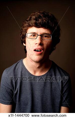 a spotty faced young man teenager youth with acne bad skin complexion wearing glasses nerd geek geeky young adult male, UK View Large Photo Image Stock Image - a spotty faced young man teenager youth with acne bad skin complexion wearing glasses nerd geek geeky young adult male, UK. Fotosearch