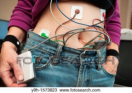 A woman wears a Holter, an ambulatory electrocardiography device, to monitor the electrical activity of her cardiovascular system The patient in this case wore the Holter for 24 hours View Large Photo Image Stock Image - A woman wears a Holter, an ambulatory electrocardiography device, to monitor the electrical activity of her cardiovascular system The patient in this case wore the Holter for 24 hours. Fotosearch