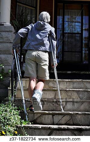 Picture - A woman with an injured right foot in open boot cautiously climbs porch steps, Ontario, Canada. Fotosearch