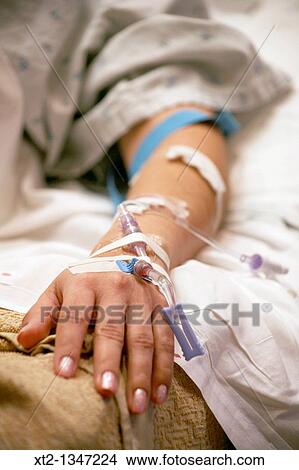 A womans arm and hand with IV tubes and tape in a hospital bed View Large Photo Image Picture - A womans arm and hand with IV tubes and tape in a hospital bed. Fotosearch