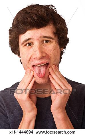 A young adult man with bad complexion, worried about his skin and health, UK View Large Photo Image Picture - A young adult man with bad complexion, worried about his skin and health, UK. Fotosearch