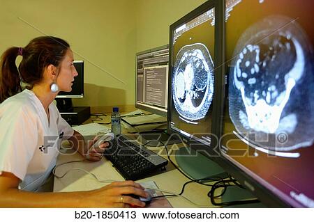 Abdominopelvic CT scan, Radiology Interpretation Review, Radiology Department, Donostia Hospital, San Sebastian, Donostia, Gipuzkoa, Basque Country, Spain View Large Photo Image Stock Image - Abdominopelvic CT scan, Radiology Interpretation Review, Radiology Department, Donostia Hospital, San Sebastian, Donostia, Gipuzkoa, Basque Country, Spain. Fotosearch