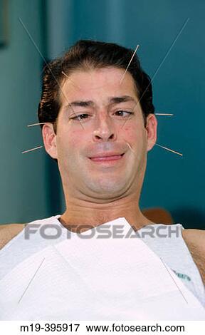 acupuncture man making a funny face View Large Photo Image Stock Photo - acupuncture man making a funny face. Fotosearch
