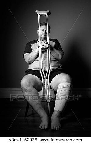 After surgery, a man with a surgically repaired broken leg with crutches View Large Photo Image Stock Photograph - After surgery, a man with a surgically repaired broken leg with crutches. Fotosearch