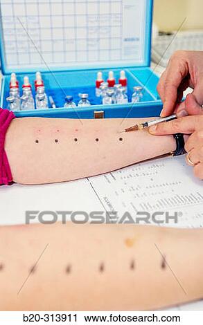 Allergy testing at hospital View Large Photo Image Stock Image - Allergy testing at hospital. Fotosearch