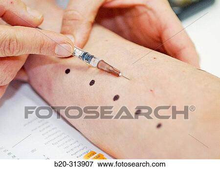 Allergy testing at hospital View Large Photo Image Stock Photo - Allergy testing at hospital. Fotosearch