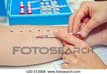 Allergy testing at hospital View Large Photo Image Stock Photo - Allergy testing at hospital. Fotosearch