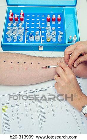 Allergy testing at hospital View Large Photo Image Stock Photo - Allergy testing at hospital. Fotosearch