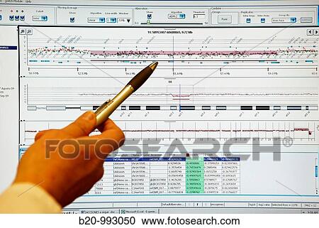 Analysis of 105 000 pieces of human DNA, prenatal diagnosis using Array CGH (Comparative Genomic Hybridization), Cytogenetics. Hospital Policlinica Gipuzkoa, San Sebastian, Donostia, Euskadi, Spain View Large Photo Image Stock Image - Analysis of 105 000 pieces of human DNA, prenatal diagnosis using Array CGH (Comparative Genomic Hybridization), Cytogenetics. Hospital Policlinica Gipuzkoa, San Sebastian, Donostia, Euskadi, Spain. Fotosearch