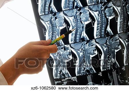 Stock Image - Analyzing an X-ray radiograph, Examinando una radiograf? a. Fotosearch