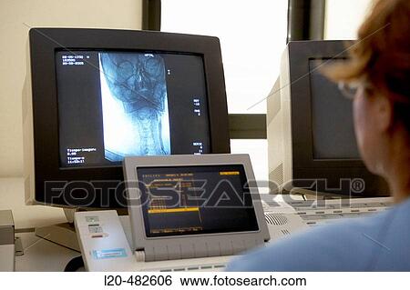 Stock Photograph - Angiography, supra-aortic trunk stenosis, interventional and vascular radiology, hemodynamics. Hospital Universitario Gran Canaria Doctor Negrin, Las Palmas de Gran Canaria. Canary Islands, Spain. Fotosearch