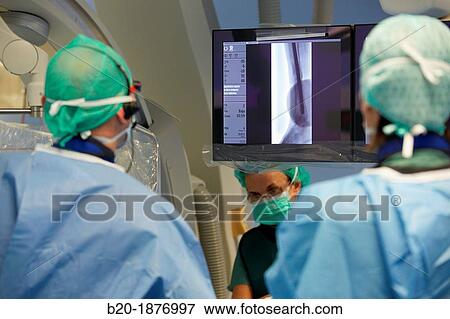 Stock Photo - Angioplasty Distal, Vascular Interventional Radiology, Operating Room, Surgery, Hospital Donostia, San Sebastian, Gipuzkoa, Basque Country, Spain. Fotosearch