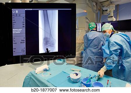 Stock Photo - Angioplasty Distal, Vascular Interventional Radiology, Operating Room, Surgery, Hospital Donostia, San Sebastian, Gipuzkoa, Basque Country, Spain. Fotosearch