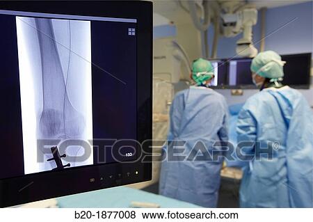 Angioplasty Distal, Vascular Interventional Radiology, Operating Room, Surgery, Hospital Donostia, San Sebastian, Gipuzkoa, Basque Country, Spain View Large Photo Image Stock Photo - Angioplasty Distal, Vascular Interventional Radiology, Operating Room, Surgery, Hospital Donostia, San Sebastian, Gipuzkoa, Basque Country, Spain. Fotosearch