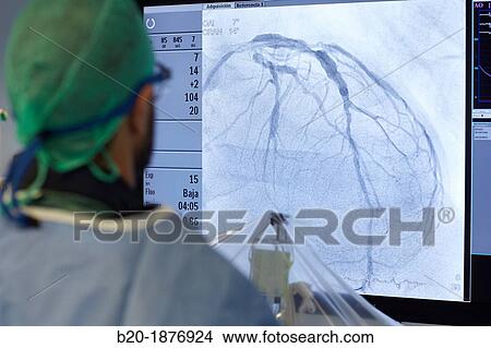 Angioplasty, Stenting in coronary arteries, Hemodynamic, Operating room, Surgery, Hospital Donostia, San Sebastian, Gipuzkoa, Basque Country, Spain View Large Photo Image Picture - Angioplasty, Stenting in coronary arteries, Hemodynamic, Operating room, Surgery, Hospital Donostia, San Sebastian, Gipuzkoa, Basque Country, Spain. Fotosearch