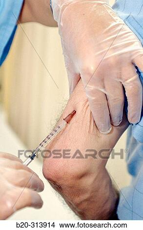 Anti-allergy vaccination at hospital View Large Photo Image Picture - Anti-allergy vaccination at hospital. Fotosearch