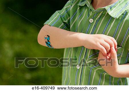 Bandage on boy's elbow. View Large Photo Image Stock Photo - Bandage on boy's elbow.. Fotosearch