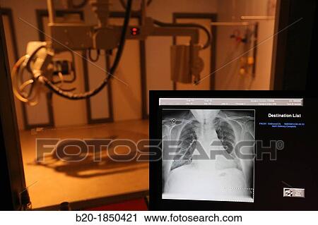 Basic chest X-ray, Radiology Department, Donostia Hospital, San Sebastian, Donostia, Gipuzkoa, Basque Country, Spain View Large Photo Image Stock Image - Basic chest X-ray, Radiology Department, Donostia Hospital, San Sebastian, Donostia, Gipuzkoa, Basque Country, Spain. Fotosearch