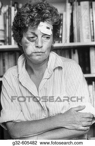 Battered woman View Large Photo Image Stock Image - Battered woman. Fotosearch