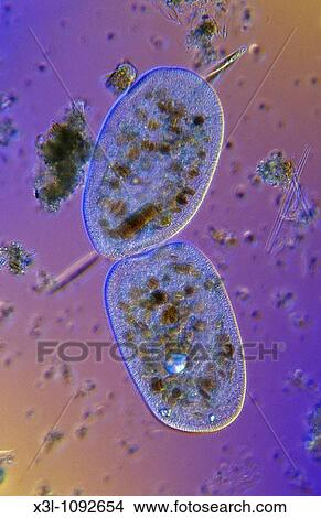 Bipartition Cell division Ciliata Protozoan Optic microscopy View Large Photo Image Picture - Bipartition Cell division Ciliata Protozoan Optic microscopy. Fotosearch