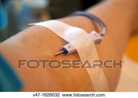 Blood donation, Hospital Puerta de Hierro, Majadahonda, Madrid, Spain, Europe View Large Photo Image Stock Image - Blood donation, Hospital Puerta de Hierro, Majadahonda, Madrid, Spain, Europe. Fotosearch