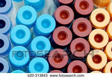 Blood sample tubes at laboratory of hospital View Large Photo Image Stock Image - Blood sample tubes at laboratory of hospital. Fotosearch