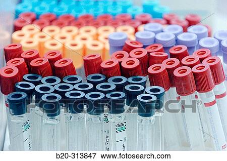 Blood sample tubes at laboratory of hospital View Large Photo Image Stock Photo - Blood sample tubes at laboratory of hospital. Fotosearch
