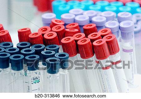 Blood sample tubes at laboratory of hospital View Large Photo Image Stock Photograph - Blood sample tubes at laboratory of hospital. Fotosearch