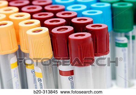 Blood sample tubes at laboratory of hospital View Large Photo Image Stock Photography - Blood sample tubes at laboratory of hospital. Fotosearch