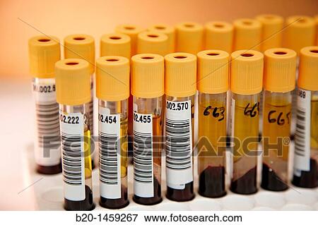 Blood samples, DNA and RNA biobank, extraction and storage of DNA/RNA from blood samples, Biodonostia Health and Biomedicine Research Institute, San Sebastian, Donostia, Gipuzkoa, Euskadi, Spain View Large Photo Image Stock Photo - Blood samples, DNA and RNA biobank, extraction and storage of DNA/RNA from blood samples, Biodonostia Health and Biomedicine Research Institute, San Sebastian, Donostia, Gipuzkoa, Euskadi, Spain. Fotosearch