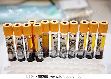 Stock Photo - Blood samples, DNA and RNA biobank, extraction and storage of DNA/RNA from blood samples, Biodonostia Health and Biomedicine Research Institute, San Sebastian, Donostia, Gipuzkoa, Euskadi, Spain. Fotosearch