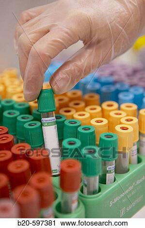 Blood test, laboratory. Hospital de Zumarraga, Gipuzkoa, Euskadi, Spain View Large Photo Image Stock Image - Blood test, laboratory. Hospital de Zumarraga, Gipuzkoa, Euskadi, Spain. Fotosearch