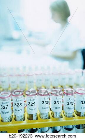 Blood test View Large Photo Image Stock Image - Blood test. Fotosearch