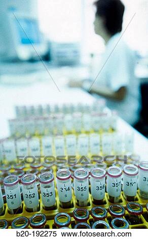 Blood test View Large Photo Image Stock Photography - Blood test. Fotosearch