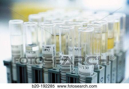 Blood test View Large Photo Image Stock Photography - Blood test. Fotosearch