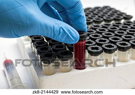 blood tubes in rack. View Large Photo Image Stock Photo - blood tubes in rack.. Fotosearch