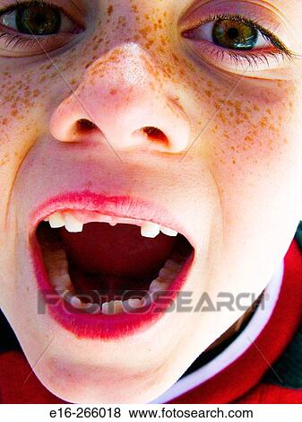 boy missing teeth View Large Photo Image Stock Photo - boy missing teeth. Fotosearch